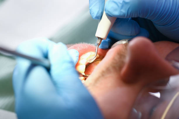 Best After-Hours Emergency Dentist in Chandler, TX