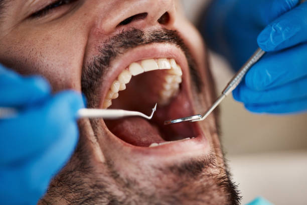 Best Emergency Root Canal Treatment in Chandler, TX
