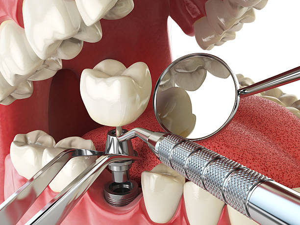 Best Emergency Dental Care for Trauma or Injury in Chandler, TX